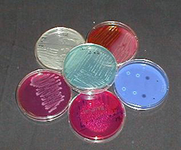 Laboruntersuchung: Mikrobiologie-2; farbige Agar-Platten