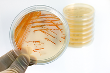Laboruntersuchung: Mikrobiologie-3; Kolonieausstrich